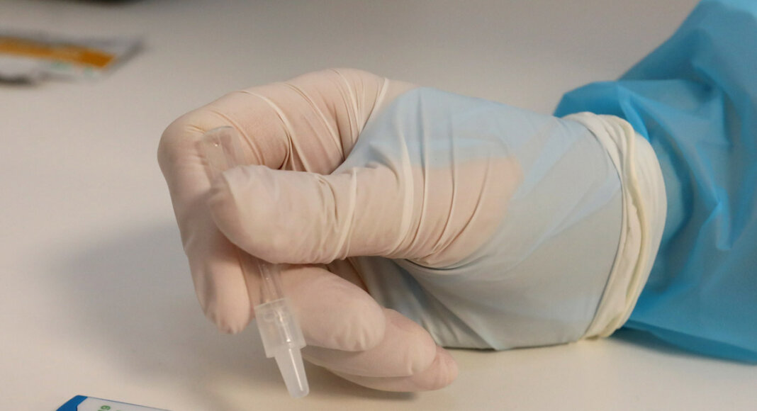Kostenlose Schnelltests können am Mittwoch auch im städtischen Zentrum am Hagen gemacht werden. Foto: Christoph Volkmer